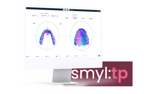 smyl-tp